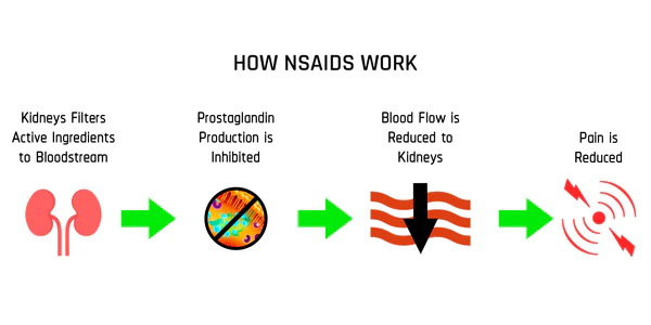 Illustration of how NSAID's work