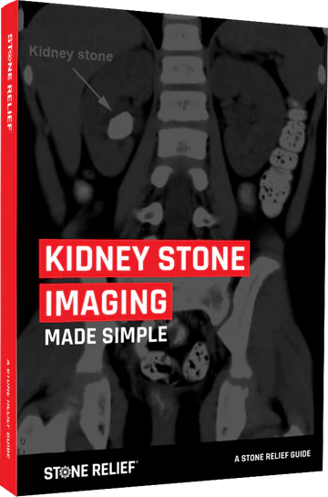 KIDNEY STONE IMAGING MADE SIMPLE