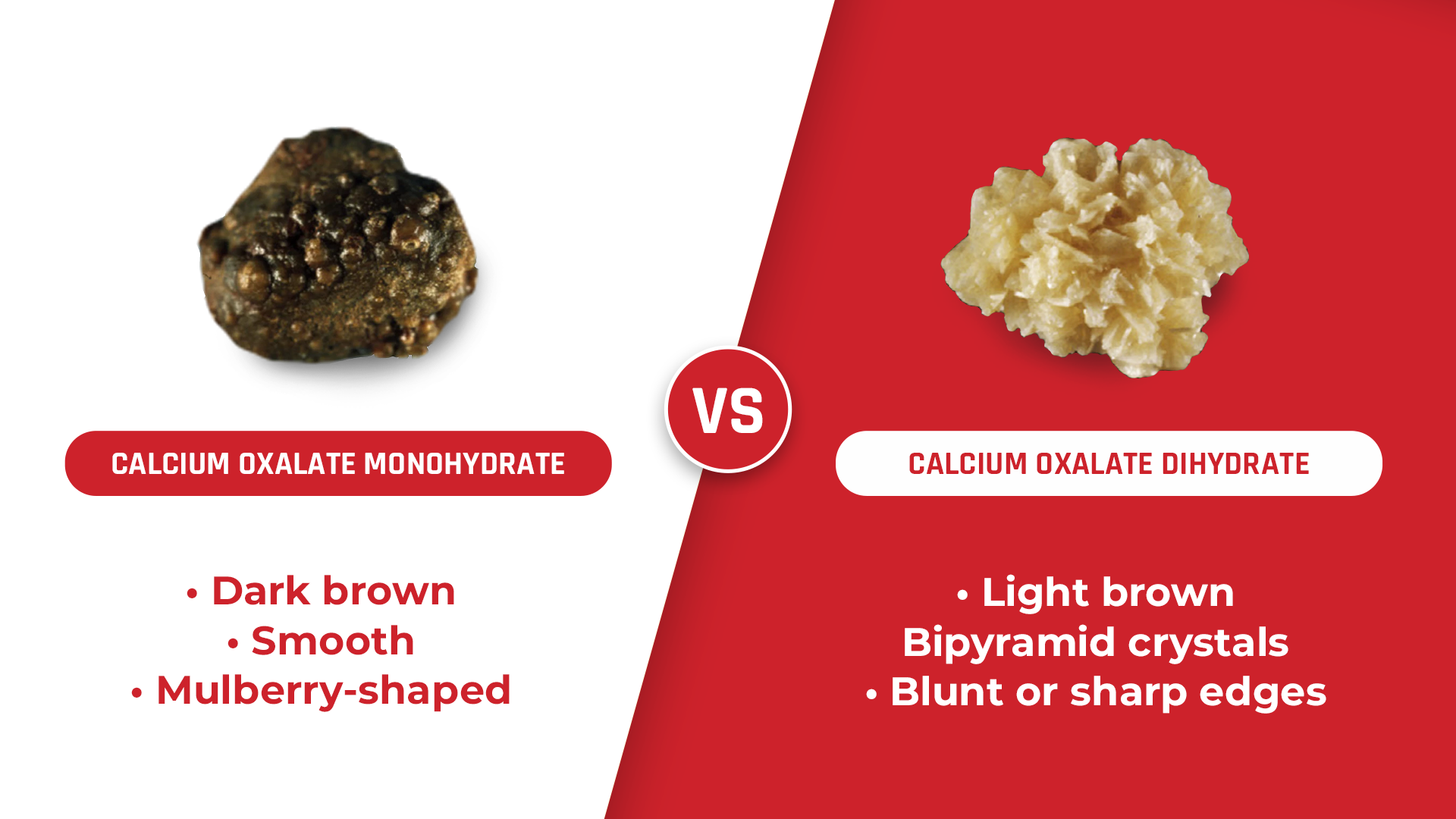 Graphic showing visual comparison of Calcium Oxalate Monohydrate (COM) and Calcium Oxalate Dihydrate (COD) stones.