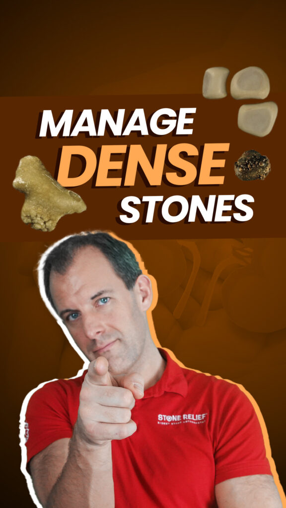 Manage Dense Calcium Oxalate Monohydrate Stones
