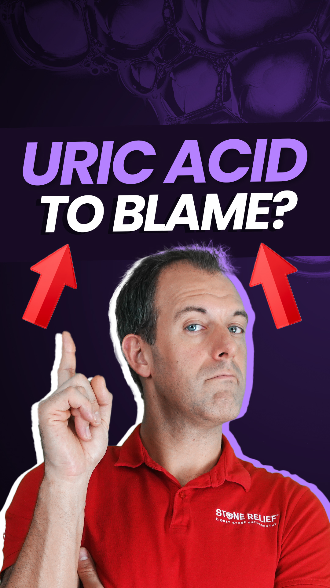 Is uric acid to blame for your kidney stone?