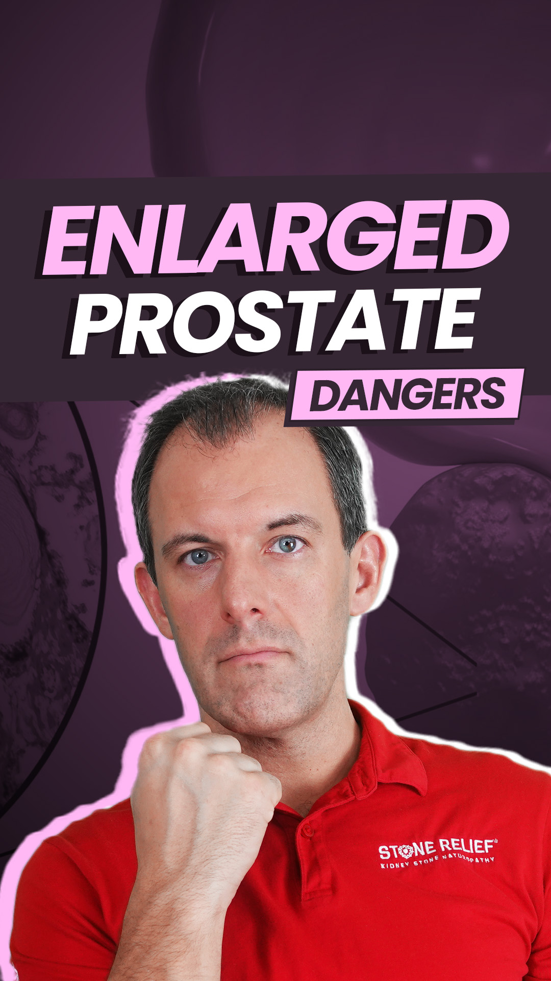 Enlarged Prostate? You are at Risk of Kidney Stones!
